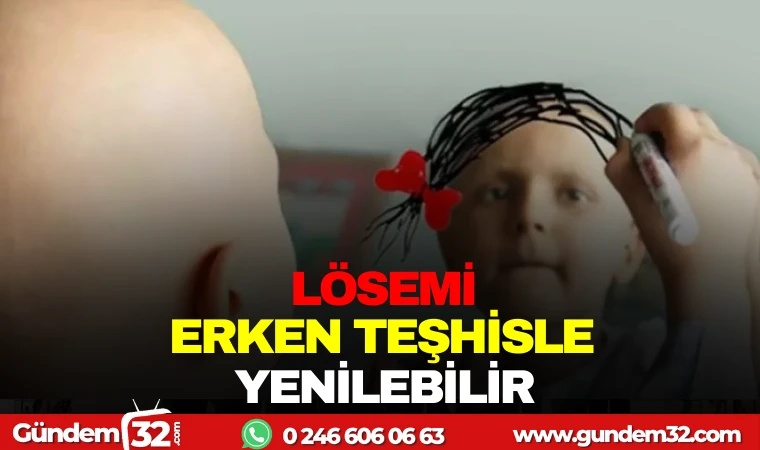 LÖSEMİ ERKEN TEŞHİSLE YENİLEBİLİR